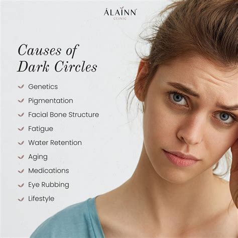 What Causes Dark Spot Under Eyes - Infoupdate.org
