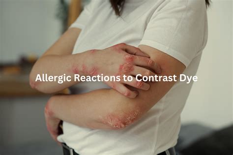 Contrast Dye Ct Side Effects