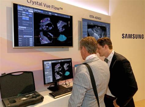 Samsung Presents Clinical Usability of its Ultrasound Imaging ...