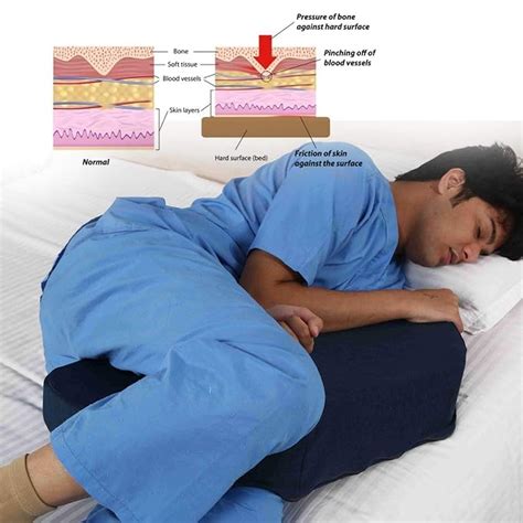 Metron- Wedge Pillow for Bed Sore Relief |Turning Wedge for Patients ...