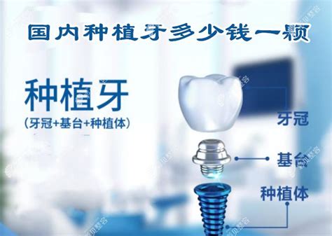 2021北京看牙价格标准新公布，种一颗牙的价格也有包含 - 爱美容研社