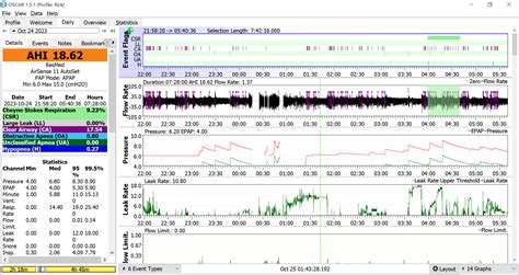 Image result for CPAP Report Example