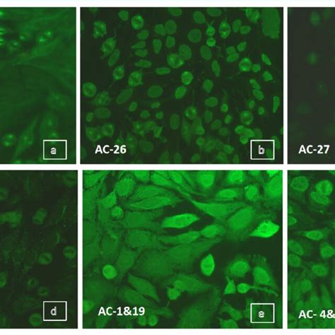 Image result for Homogeneous Pattern