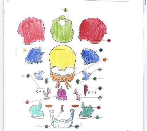 Image result for Exploded Skull