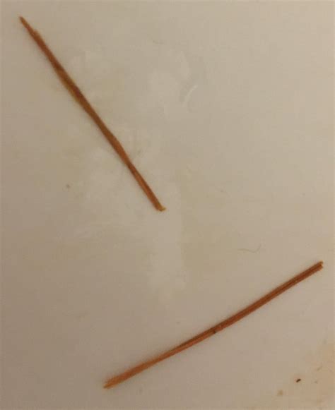 Weird straws like fiber strings in poop : r/shittingadvice