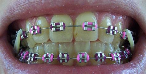 Image result for Color Wheel Toothpaste Reviews