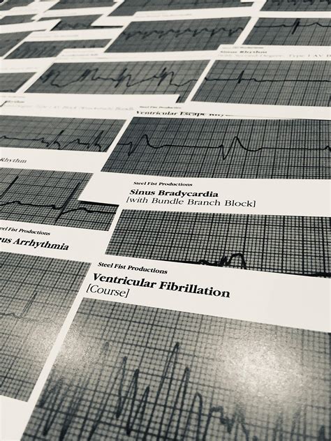 Snapklik.com : EKG ECG Cardiac Acls Rhythm Strip Flashcards