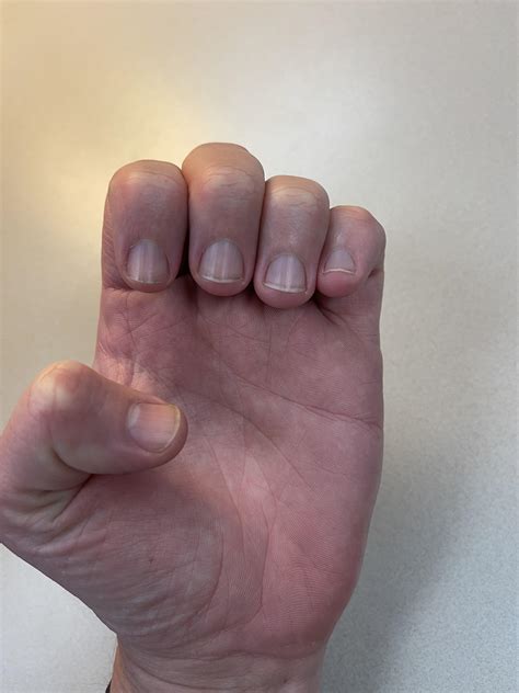 Lengthening nail bed by pushing cuticle/nail fold? : r/Nails