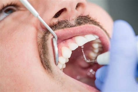 Teeth Cleaning Routine 的图像结果