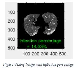 MATLAB Coronavirus 的图像结果