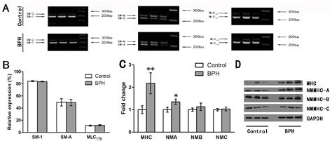 Alteration of the Expression and Functional Activities of Myosin II ...