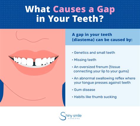 What Does Gap In The Teeth Mean - Infoupdate.org