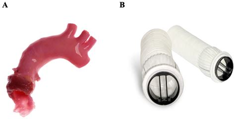 Prosthetic Heart Valves: More than Half a Century of Innovation—An Overview