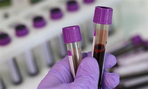 Drishti Yadav, Live Law