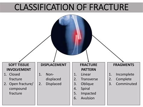 Types of Fractures | PPTX
