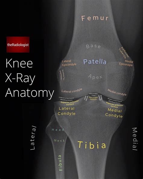 Knee Xray Anatomy Anatomy Of The Knee (CT Arthrography) | E Anatomy