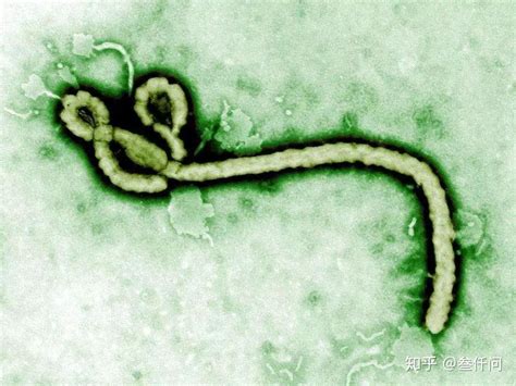 「埃博拉病毒」是一种怎样的病毒？ - 知乎