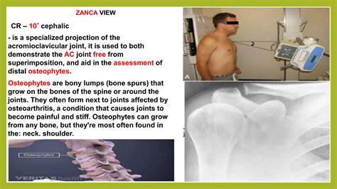 (4-M) 301 - A Shoulder to Clavicle.pptx