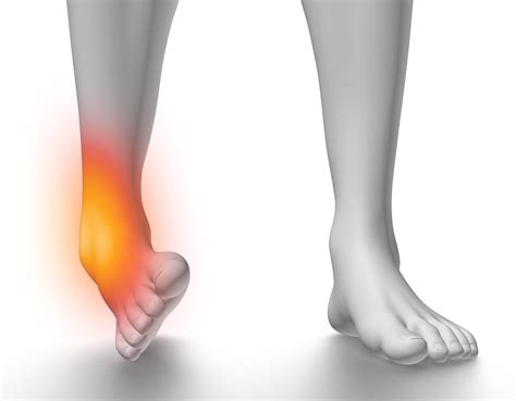Sprained Ankle Symptoms & Pain Treatment | Advanced Foot & Ankle