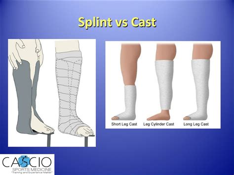 PPT - The A B C’s of Playground Bone and Joint Injuries PowerPoint ...