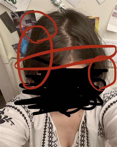 What causes pain/pressure in these areas? Normally I get ice pick headaches on the left side ...