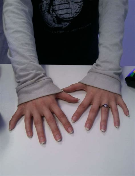 Image result for Genetics in Hand Shape