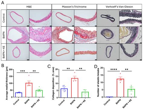 Ketone Ester Attenuates Thoracic Aortic Aneurysm and Dissection by ...