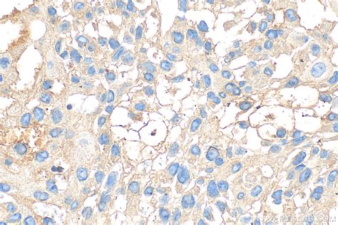 EGFR antibody (30847-1-AP) | Proteintech