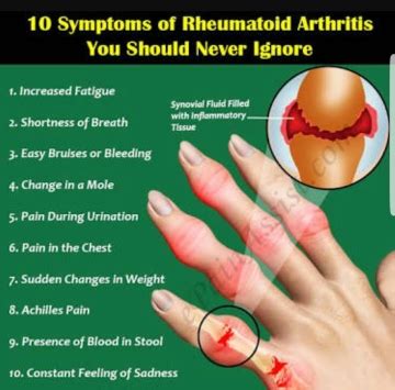 What is Anti CCP Antibodies Lab Test