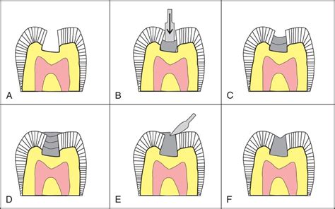 Image result for Help Tale Amalgam