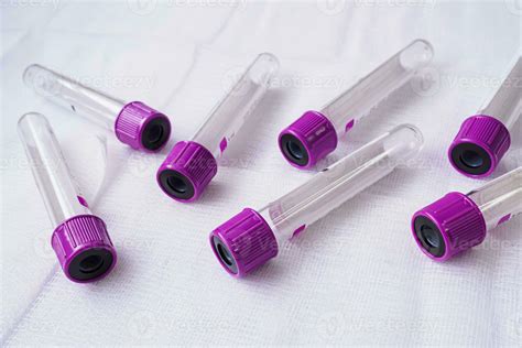 Image result for Sampling Test Tubes