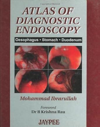 Buy ATLAS OF DIAGNOSTIC ENDOSCOPY Book Online at Low Prices in India ...
