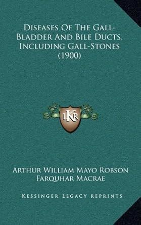 Buy Diseases of the Gall-Bladder and Bile Ducts, Including Gall-Stones ...