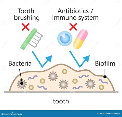 Dental Biofilm Formation at Pamela Walsh blog