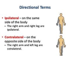 Image result for Contralateral Weakness