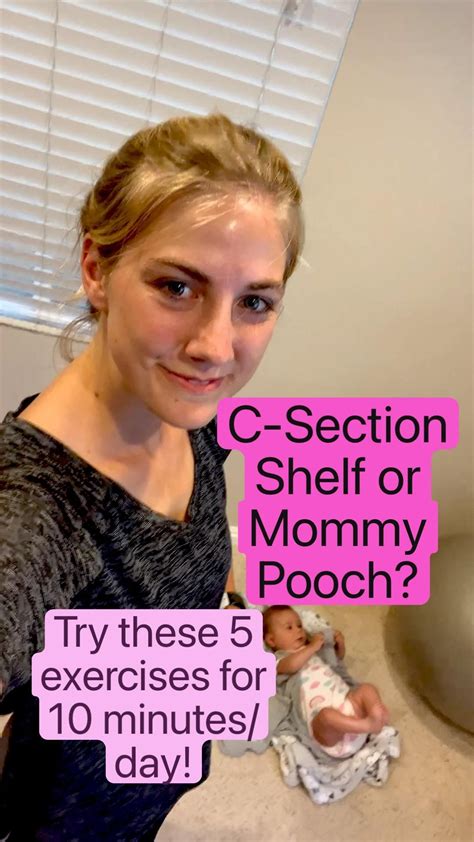 C-Section Shelf or Mommy PoochDR safe exercises for flat tummy after ...
