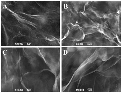 Double Biocatalysis Signal Amplification Glucose Biosensor Based on ...