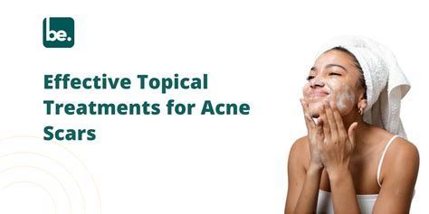 Effective Topical Treatments for Acne Scars - Belogical Wellness ...