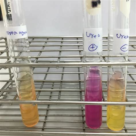 Image result for Urease Pronounce