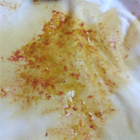 Red spots in stool should i worry – FirstCry Parenting