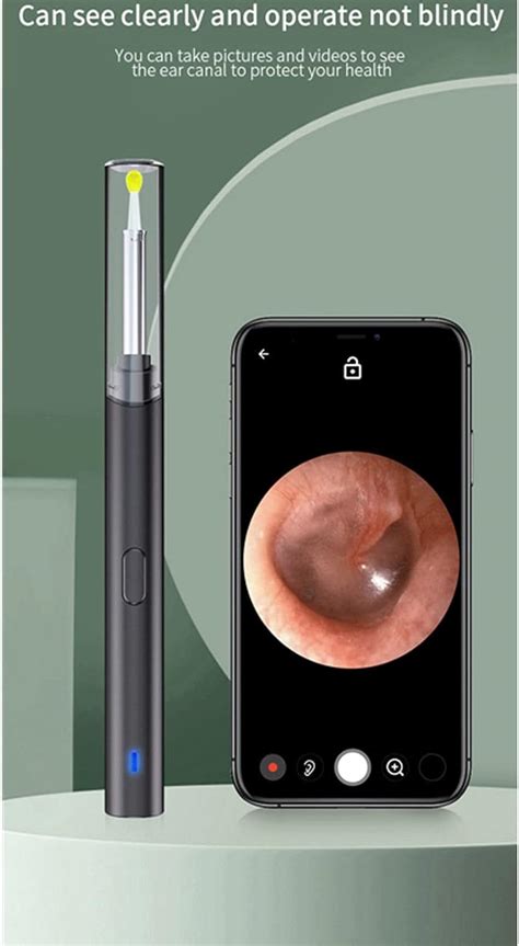 Buy Ear Wax Removal Tool- Ear Cleaner with Camera Otoscope with Light ...