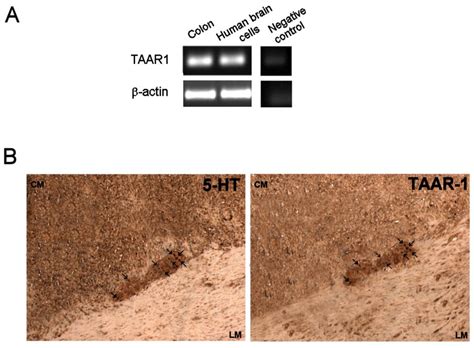 Image result for Reverse Transcriptase PCR