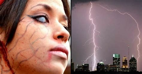 These 10 People Miraculously Survived After Struck By Lightning
