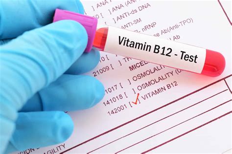 Image result for Normal B12 Levels