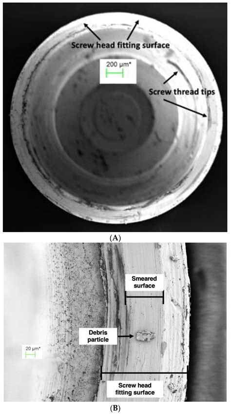 Effect of Electrodeposited Gold Coatings on Micro-Gaps, Surface Profile ...