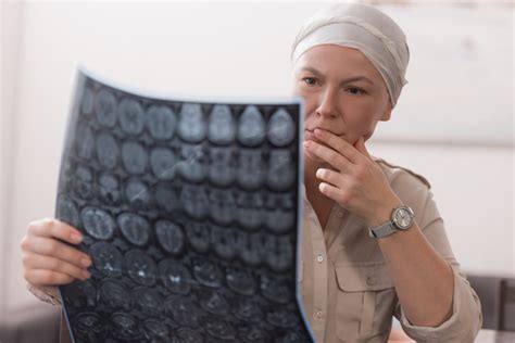 Why Does Chemotherapy Cause Hair Loss? – Fashion Digger