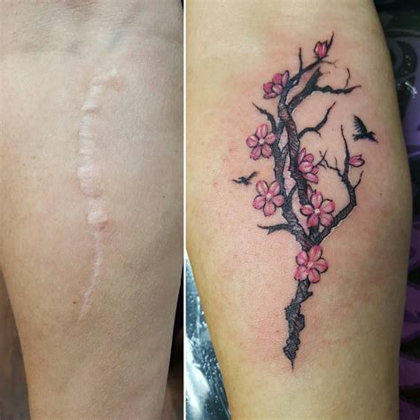 Knee Replacement Scar Tattoo Cover Up - Watercolor Tattoo Design