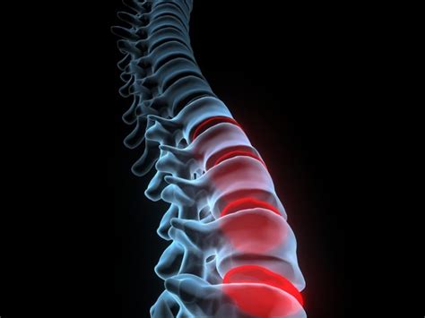 HWS-Syndrom Schwindel 的图像结果