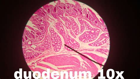 Duodenum Histology