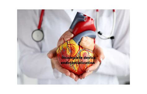 Incidence and potential risk factors and clinical impacts of incomplete ...